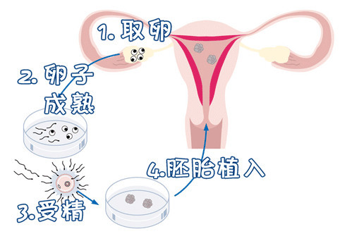 借卵代孕哪里做的最好